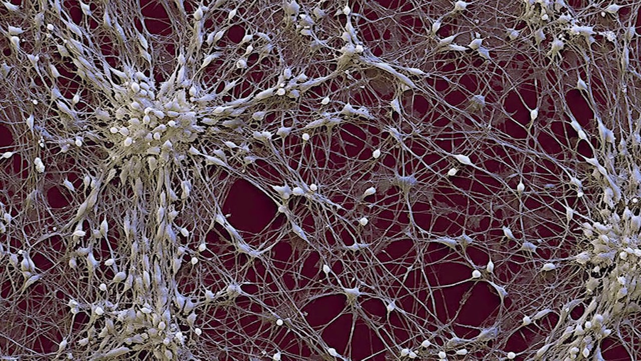 Нейронные связи головного мозга под микроскопом
